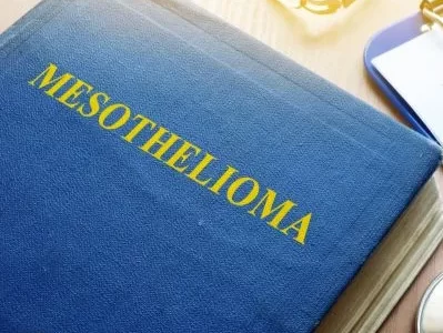Epithelial Mesothelioma – All You Need to Know