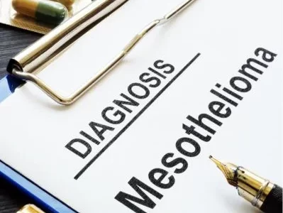 What to Look for in a Top Mesothelioma Doctor in the U.S.