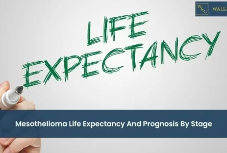 Mesothelioma Life Expectancy and Prognosis by Stage